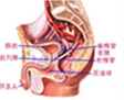 合肥治疗前列腺医院